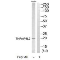 Western blot analysis of extracts from HuvEc cells, using TNFAIP8L2 antibody. Western blot analysis of extracts from HuvEc cells, using TNFAIP8L2 antibody.