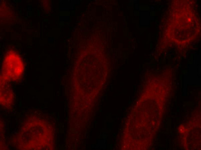 Immunofluorescence staining of methanol-fixed Hela cells using eIF2a(Phospho-Ser51) Antibody.