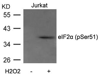 Western blot analysis of extracts from Jurkat cells untreated or treated with H2O2 using eIF2a(Phospho-Ser51) Antibody. Western blot analysis of extracts from Jurkat cells untreated or treated with H2O2 using eIF2a(Phospho-Ser51) Antibody.