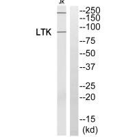 Western blot analysis of extracts from Jurkat cells, using LTK antibody. Western blot analysis of extracts from Jurkat cells, using LTK antibody.