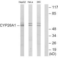 Western blot analysis of extracts from HepG2 cells, HeLa cells and 293 cells, using Cytochrome P450 26A1 antibody. Western blot analysis of extracts from HepG2 cells, HeLa cells and 293 cells, using Cytochrome P450 26A1 antibody.