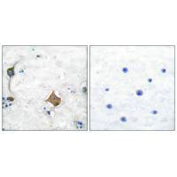 Immunohistochemical analysis of paraffin-embedded human brain tissue using Synaptophysin antibody.