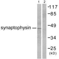 Western blot analysis of extracts from LOVO cells, using Synaptophysin antibody. Western blot analysis of extracts from LOVO cells, using Synaptophysin antibody.