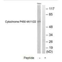 Western blot analysis of extracts from COLO205, HuvEc and HeLa cells, using CYTOCHROME P450 4A11/22 antibody. Western blot analysis of extracts from COLO205, HuvEc and HeLa cells, using CYTOCHROME P450 4A11/22 antibody.