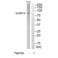 Western blot analysis of extracts from HuvEC cells, using DGKB antibody. Western blot analysis of extracts from HuvEC cells, using DGKB antibody.