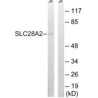 Western blot analysis of extracts from Jurkat cells, using SLC28A2 antibody. Western blot analysis of extracts from Jurkat cells, using SLC28A2 antibody.
