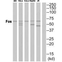 Western blot analysis of extracts from HepG2 cells, using Fos antibody.