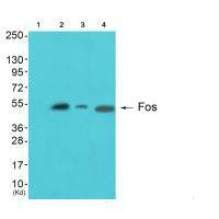 Western blot analysis of extracts from A549 cells (Lane 2), Hela cells (Lane 3) and JK cells (Lane 4), using Fos antiobdy. The lane on the left is treated with synthesized peptide.