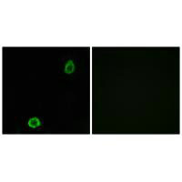 Immunofluorescence analysis of A549 cells, using ABCA13 antibody. Immunofluorescence analysis of A549 cells, using ABCA13 antibody.