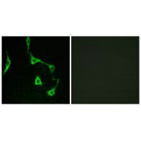 Immunofluorescence analysis of LOVO cells, using CDH10 antibody. Immunofluorescence analysis of LOVO cells, using CDH10 antibody.