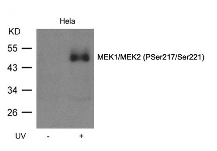 Western blot analysis of extracts from Hela cell untreated or treated with UV MEK1/MEK2(Phospho-Ser217/Ser221) Antibody Western blot analysis of extracts from Hela cell untreated or treated with UV MEK1/MEK2(Phospho-Ser217/Ser221) Antibody