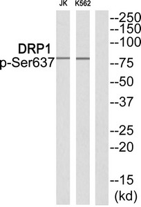 Western blot analysis of extracts from JK cells and K562 cells using DRP1 (Phospho-Ser637) Antibody.The lane on the right is treated with the antigen-specific peptide. Western blot analysis of extracts from JK cells and K562 cells using DRP1 (Phospho-Ser637) Antibody.The lane on the right is treated with the antigen-specific peptide.