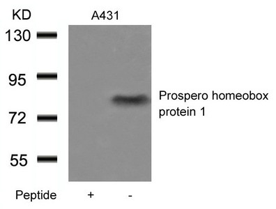 Western blot analysis of extracts from A431 cells using Prospero homeobox protein 1 Antibody and the same antibody preincubated with blocking peptide. Western blot analysis of extracts from A431 cells using Prospero homeobox protein 1 Antibody and the same antibody preincubated with blocking peptide.