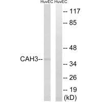 Western blot analysis of extracts from HUVEC cells, using CA3 antibody. Western blot analysis of extracts from HUVEC cells, using CA3 antibody.