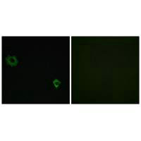 Immunofluorescence analysis of HuvEc cells, using RPL34 antibody.