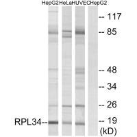 Western blot analysis of extracts from HepG2 cells, HeLa cells and HUVEC cells, using RPL34 antibody. Western blot analysis of extracts from HepG2 cells, HeLa cells and HUVEC cells, using RPL34 antibody.