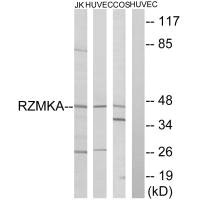 Western blot analysis of extracts from Jurkat cells, HuvEc cells and COS cells, using RIMKA antibody. Western blot analysis of extracts from Jurkat cells, HuvEc cells and COS cells, using RIMKA antibody.
