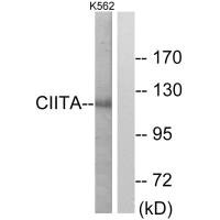 Western blot analysis of extracts from K562 cells, using CIITA antibody. Western blot analysis of extracts from K562 cells, using CIITA antibody.