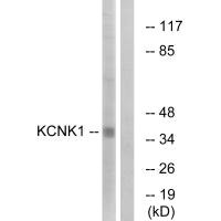 Western blot analysis of extracts from Jurkat cells, using KCNK1 antibody. Western blot analysis of extracts from Jurkat cells, using KCNK1 antibody.