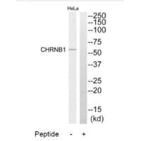 Western blot analysis of extracts from HeLa cells, using CHRNB1 antibody. Western blot analysis of extracts from HeLa cells, using CHRNB1 antibody.