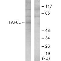 Western blot analysis of extracts from 293 cells, using TAF6L antibody. Western blot analysis of extracts from 293 cells, using TAF6L antibody.
