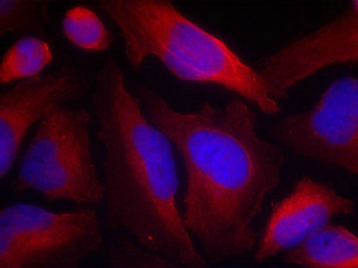 Immunofluorescence staining of methanol-fixed Hela cells using Tyrosine Hydroxylase(Phospho-Ser19) Antibody. Immunofluorescence staining of methanol-fixed Hela cells using Tyrosine Hydroxylase(Phospho-Ser19) Antibody.