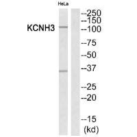 Western blot analysis of extracts from HeLa cells, using KCNH3 antibody. Western blot analysis of extracts from HeLa cells, using KCNH3 antibody.