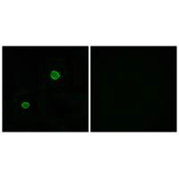 Immunofluorescence analysis of MCF-7 cells, using APOL4 antibody.