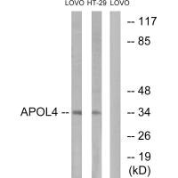 Western blot analysis of extracts from LOVO cells and HT-29cells, using APOL4 antibody. Western blot analysis of extracts from LOVO cells and HT-29cells, using APOL4 antibody.