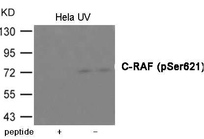 Western blot analysis of extracts from Hela cells treated with UV using C-RAF (Phospho-Ser621) Antibody.The lane on the left is treated with the antigen-specific peptide.