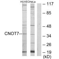 Western blot analysis of extracts from HUVEC cells and HeLa cells, using CNOT7 antibody. Western blot analysis of extracts from HUVEC cells and HeLa cells, using CNOT7 antibody.