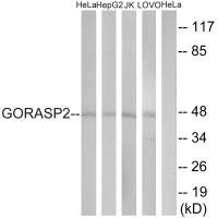 Western blot analysis of extracts from HeLa cells, HepG2 cells, Jurkat cells and LOVO cells, using GORASP2 antibody. Western blot analysis of extracts from HeLa cells, HepG2 cells, Jurkat cells and LOVO cells, using GORASP2 antibody.