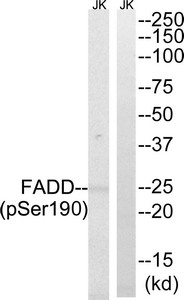 Western blot analysis of extracts from Jurkat cells treated with PMA using FADD (Phospho-Ser190) Antibody.The lane on the right is treated with the antigen-specific peptide. Western blot analysis of extracts from Jurkat cells treated with PMA using FADD (Phospho-Ser190) Antibody.The lane on the right is treated with the antigen-specific peptide.