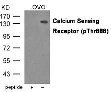 Western blot analysis of extracts from LOVO cells using Calcium Sensing Receptor (Phospho-Thr888) Antibody.The lane on the left is treated with the antigen-specific peptide. Western blot analysis of extracts from LOVO cells using Calcium Sensing Receptor (Phospho-Thr888) Antibody.The lane on the left is treated with the antigen-specific peptide.