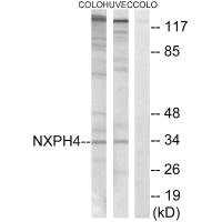 Western blot analysis of extracts from COLO cells and HUVEC cells, using NXPH4 antibody. Western blot analysis of extracts from COLO cells and HUVEC cells, using NXPH4 antibody.