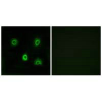 Immunofluorescence analysis of A549 cells, using ABHD6 antibody.