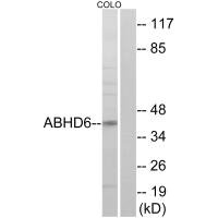 Western blot analysis of extracts from COLO cells, using ABHD6 antibody. Western blot analysis of extracts from COLO cells, using ABHD6 antibody.
