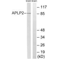 Western blot analysis of extracts from rat brain cells, using APLP2 (Ab-755) antibody. Western blot analysis of extracts from rat brain cells, using APLP2 (Ab-755) antibody.