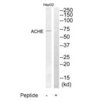 Western blot analysis of extracts from HepG2 cells, using ACHE antibody. Western blot analysis of extracts from HepG2 cells, using ACHE antibody.