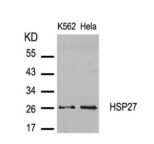 Western blot analysis of extracts from K562 and Hela cells using HSP27(Ab-82) Antibody. Western blot analysis of extracts from K562 and Hela cells using HSP27(Ab-82) Antibody.