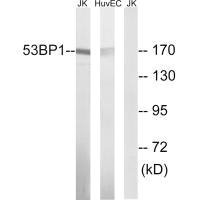 Western blot analysis of extracts from Jurkat cells and HUVEC cells, using 53BP1 (Ab-29) antibody. Western blot analysis of extracts from Jurkat cells and HUVEC cells, using 53BP1 (Ab-29) antibody.