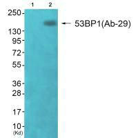 Western blot analysis of extracts from 293 cells (Lane 2), using 53BP1 (Ab-29) antiobdy. The lane on the left is treated with synthesized peptide.