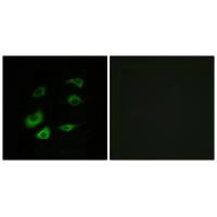 Immunofluorescence analysis of HepG2 cells, using Cyclosome 1 antibody. Immunofluorescence analysis of HepG2 cells, using Cyclosome 1 antibody.