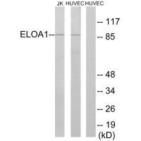 Western blot analysis of extracts from Jurkat cells and HUVEC cells, using ELOA1 antibody. Western blot analysis of extracts from Jurkat cells and HUVEC cells, using ELOA1 antibody.