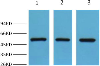 Western blot analysis of Hela (lane 1), mouse brain (lane 2) and HepG2 (lane 3), using diluted at 1:2,000.