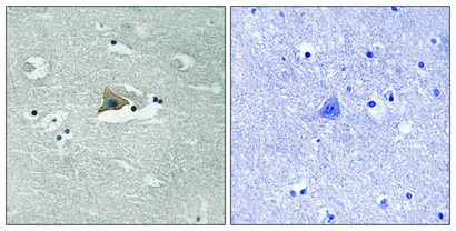 Immunohistochemical analysis of paraffin-embedded human brain tissue using Claudin 5 (Phospho-Tyr217) antibody (left)or the same antibody preincubated with blocking peptide (right). Immunohistochemical analysis of paraffin-embedded human brain tissue using Claudin 5 (Phospho-Tyr217) antibody (left)or the same antibody preincubated with blocking peptide (right).