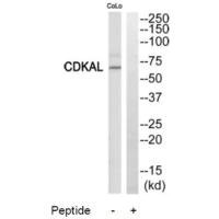 Western blot analysis of extracts from COLO205 cells, using CDKAL antibody. Western blot analysis of extracts from COLO205 cells, using CDKAL antibody.