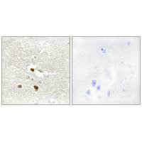 Immunohistochemistry analysis of paraffin-embedded human brain tissue using ZNF287 antibody.