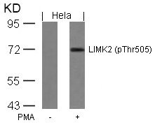 Western blot analysis of extracts from Hela cells untreated or treated with PMA using LIMK2(Phospho-Thr505) Antibody. Western blot analysis of extracts from Hela cells untreated or treated with PMA using LIMK2(Phospho-Thr505) Antibody.