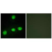 Immunofluorescence analysis of HUVEC cells, using CLK1 antibody.